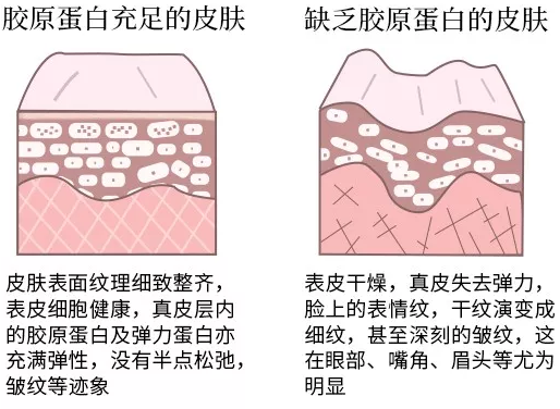 补充胶原蛋白到底有没有用.png