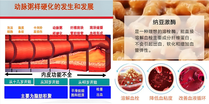 纳豆激酶抗动脉粥样硬化作用.png